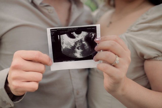 Comprehending the Criteria and Benefits of Being an Egg Donor