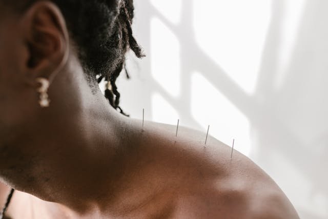 Integrated Approaches for OCD: Merging Mental and Physical Wellness